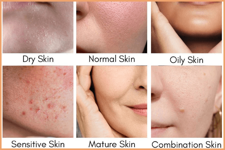 How Often Should You Shower - It depends on different skin type